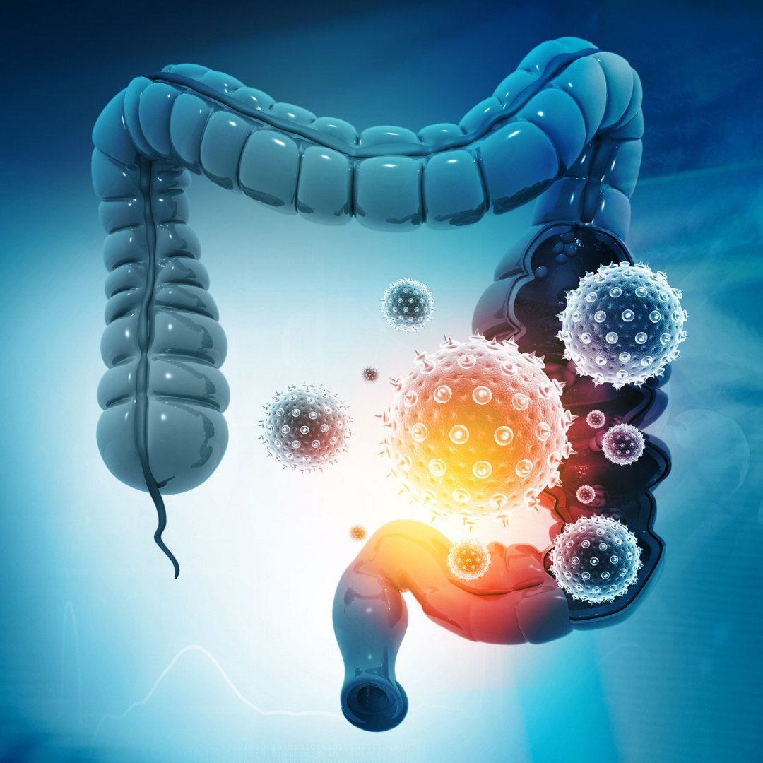 Gentle gut adsorbent Enterosgel® – binds toxins causing diarrhoea and vomiting